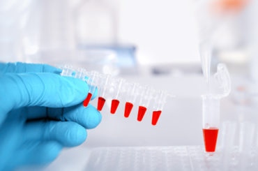 Parkinson’s disease biomarkers