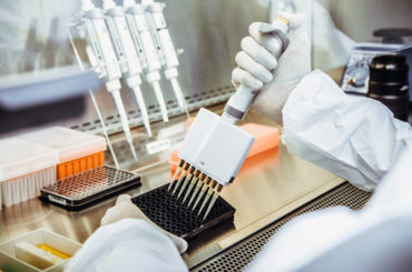 Parkinson’s disease biomarkers