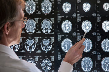 biomarkers in brain diagnostics