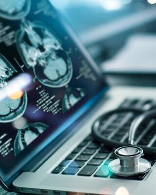 Webinar: drug development challenge in early Parkinson's