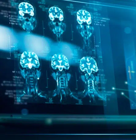 Enhance neurodegenerative disease trials with biomarkers and precision medicine.