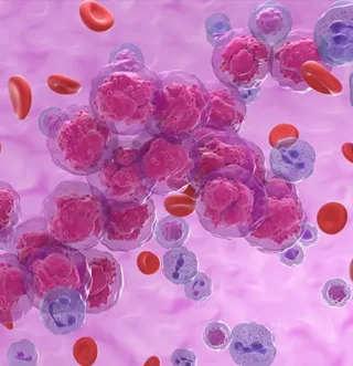 How precision medicine is transforming hematology-oncology