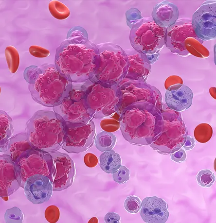 Precision Medicine in Hematology-Oncology: Effectively Tailoring Treatments Based on Genetic & Molecular Profiling