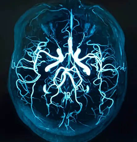 Strategic Planning for Neurodegeneration Studies: A Checklist to Navigate Study Complexity