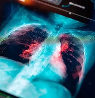 Discover how Worldwide Clinical Trials delivered a global FIH ADC lung cancer trial.