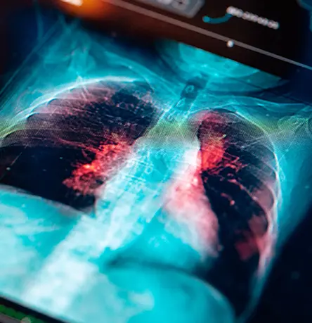 Accelerating a Global, FIH ADC Therapy Trial for Lung Cancer